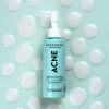 ACNE-Sebum-Control-gel-curatare-2